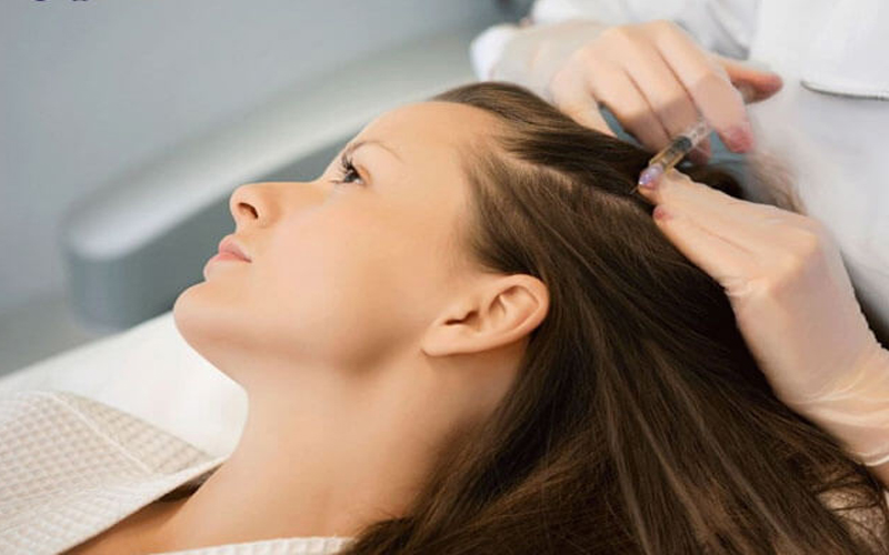 Phương pháp cấy tinh chất trực tiếp vào da đầu